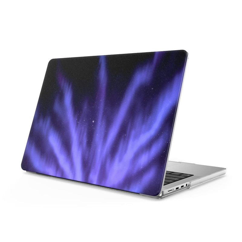 Dazzling - Macbook Case