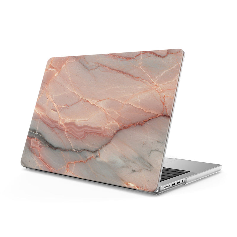 Elegant Rose Gold - Macbook Case