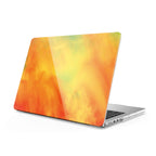 Echo - Macbook Case