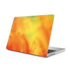 Echo - Macbook Case