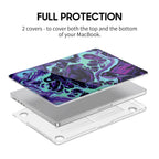 Dark Gold Matter - Macbook Case