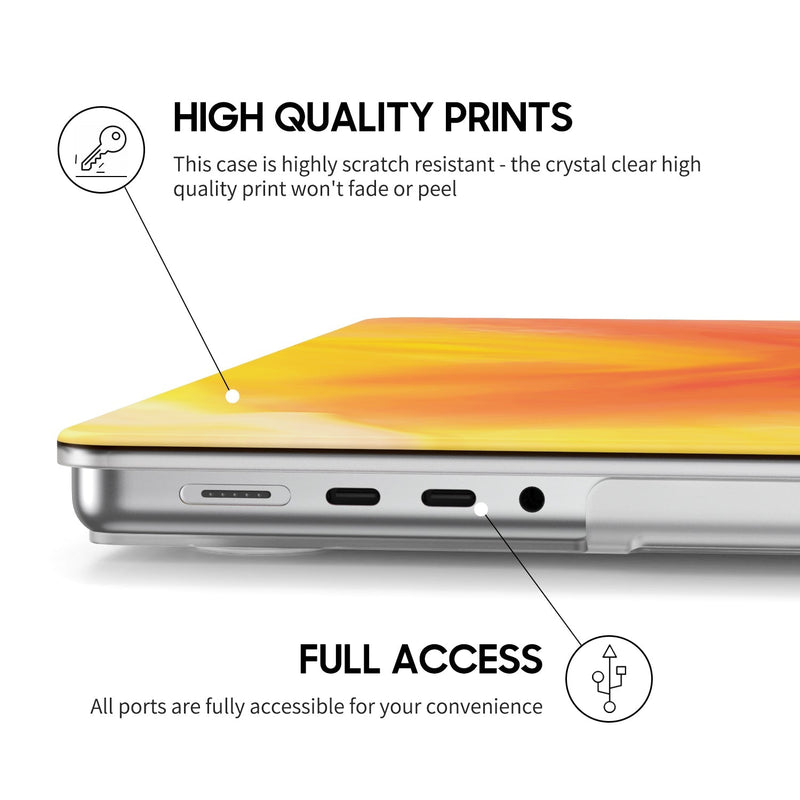Forget - Macbook Case