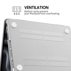 Multiple Bodies - Macbook Case